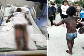 Chuyện lạ hôm nay: “Đừng lo... có mẹ” và điều cảm động trong đám cháy 