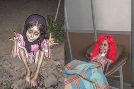 Cô gái trông hệt như xác sống và sự thực rợn người