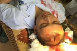 Bộ Y tế yêu cầu xử lý nghiêm đối tượng hành hung bác sỹ