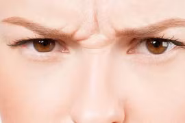 Tuyệt chiêu “xóa” nếp nhăn sống mũi