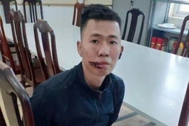 Giám định tâm thần kẻ giết mẹ, chém cha bị thương