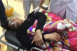 Tạm giữ 5 kẻ hành hung gãy sống mũi bác sĩ tại trung tâm y tế ở Hải Dương