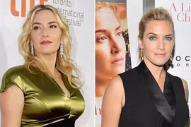 Kate Winslet bị nghi dao kéo sau khi sinh con thứ 3