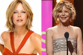 Phát hoảng với mặt cứng đờ, biến dạng của sao Hollywood vì Botox