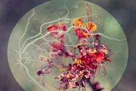 Ngỡ ngàng xem hoa nở trong nhãn cầu mắt