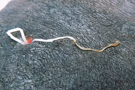 Kinh hãi cảnh giun ký sinh bị kéo ra khỏi chân người