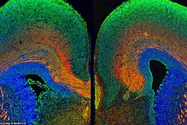 Hình ảnh rực rỡ khó tin về... cấu trúc não bộ