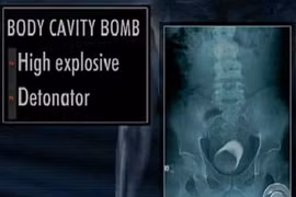 Khủng bố dùng chiêu gì mang vũ khí lên máy bay?