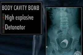 Khủng bố dùng chiêu gì mang vũ khí lên máy bay?