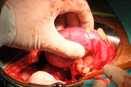 Chuyện rùng rợn ở đường dây bán nội tạng xuyên Việt