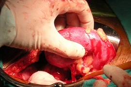 Chuyện rùng rợn ở đường dây bán nội tạng xuyên Việt