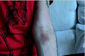 Những quan niệm khoa học tưởng “trên trời” hóa đúng (2)