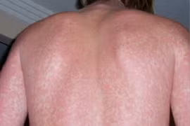 Những con số giật mình từ biến đổi khí hậu