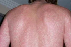 Những con số giật mình từ biến đổi khí hậu