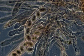 Xem nấm biến hình kỳ quái dưới kính hiển vi 