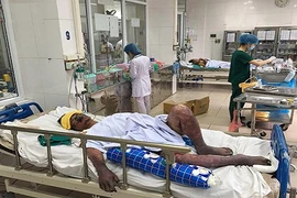 Đừng vì tiết canh mà mất Tết