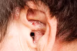 Hình dáng đôi tai nói gì về sức khỏe của bạn