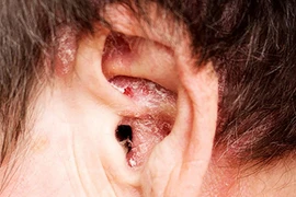 Hình dáng đôi tai nói gì về sức khỏe của bạn