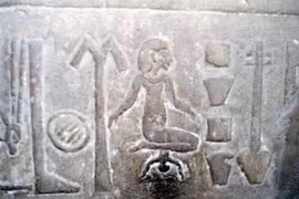 6 quái chiêu chữa bệnh kinh dị nhất lịch sử cổ đại 