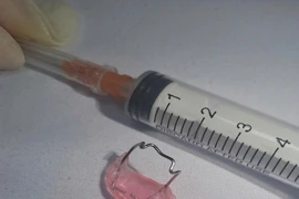 Dị vật đường tiêu hóa: hiểm họa khó lường