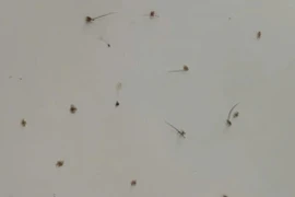 Rận bám chi chít trên mi mắt người phụ nữ 46 tuổi