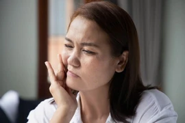 Trời lạnh đề phòng liệt mặt, méo miệng