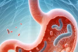 "Điểm" loạt thực phẩm hỗ trợ kiểm soát vi khuẩn HP trong dạ dày