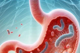 "Điểm" loạt thực phẩm hỗ trợ kiểm soát vi khuẩn HP trong dạ dày