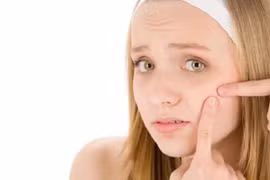 Tips chăm sóc da đúng cách cho tuổi dậy thì