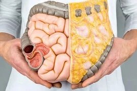 Cách "đào thải" mỡ nội tạng ở người trung niên