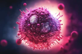 Người thứ 7 trên thế giới được chữa HIV nhờ liệu pháp tế bào gốc