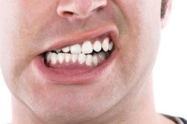 Thói quen xấu có thể gây biến dạng khuôn mặt, bất ngờ số 1