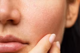 8 thói quen xấu hàng ngày khiến da khô