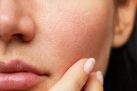 8 thói quen xấu hàng ngày khiến da khô