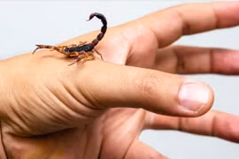 Thiếu nữ 16 tuổi bị sốc phản vệ do bọ cạp cắn