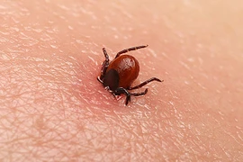 Người phụ nữ 69 tuổi nguy kịch tính mạng vì bị mò đốt