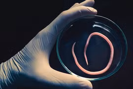 Bất ngờ phát hiện mắc 6 loại giun, sán từ những thói quen hàng ngày