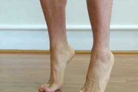 Mách nhỏ 6 bài tập phục hồi cho bàn chân bẹt hiệu quả