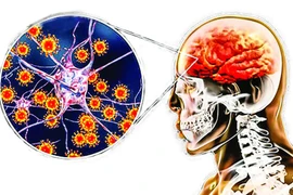 Bệnh viêm não Nhật Bản lây truyền qua đường nào?