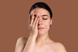 "Điểm mặt" 5 tác hại tiềm ẩn của kem chống nắng nếu dùng sai cách