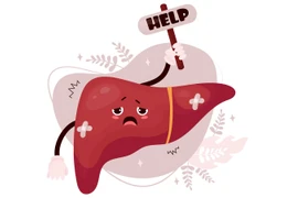 Dấu hiệu cảnh báo lá gan đang suy giảm chức năng