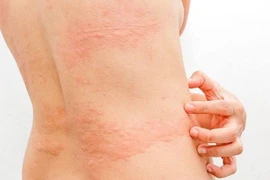 Dấu hiệu cảnh báo cơ thể đang "kêu cứu" cần được thanh lọc