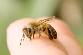 Sốc phản vệ, ngưng tim do ong đốt