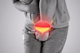 Trót đi "bóc bánh trả tiền", người đàn ông mắc bệnh kín nguy hiểm