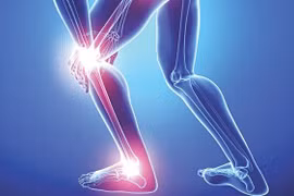  7 loại thực phẩm "sát thủ rút cạn canxi" ăn nhiều gây giòn xương 