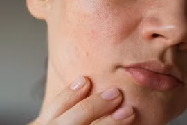 Vì sao bổ sung collagen thường xuyên da vẫn 'xuống cấp không phanh'?