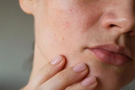 Vì sao bổ sung collagen thường xuyên da vẫn 'xuống cấp không phanh'?