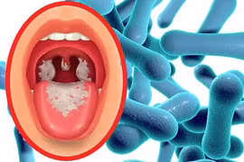 Các biện pháp phòng chống bệnh bạch hầu