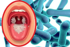 Các biện pháp phòng chống bệnh bạch hầu