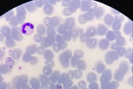 Đi rừng ở nước ngoài về, người đàn ông 31 tuổi mắc sốt rét ngoại lai